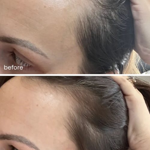 hair growth serum uklash ukhair serum 30 121643