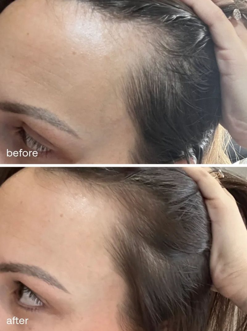 hair growth serum uklash ukhair serum 30 121643