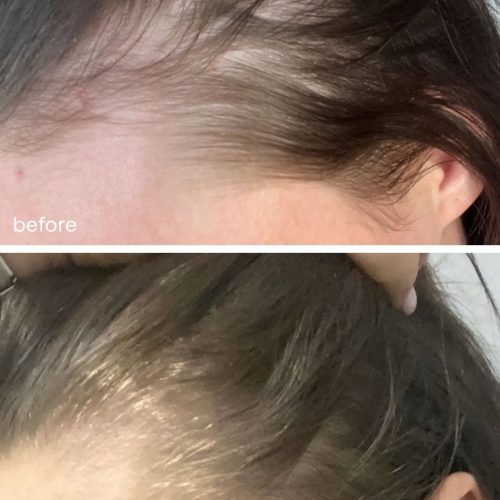 hair growth serum uklash ukhair serum 30 810708