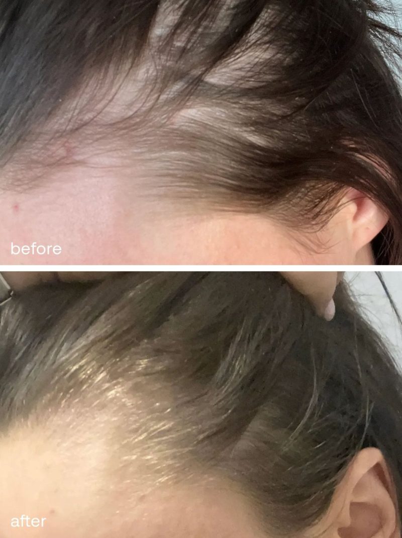 hair growth serum uklash ukhair serum 30 810708